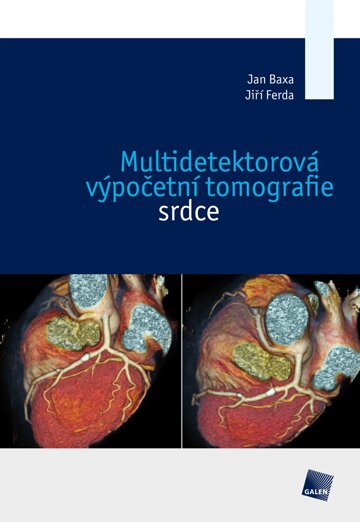 Obálka knihy Multidetektorová výpočetní tomografie srdce