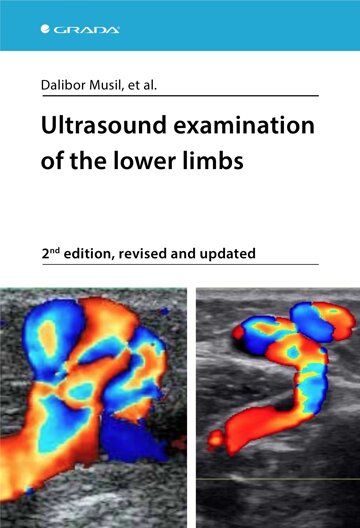 Obálka knihy Ultrasound examination of the lower limbs