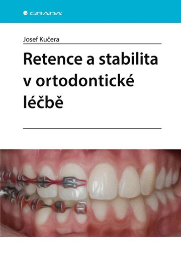 Obálka knihy Retence a stabilita v ortodontické léčbě