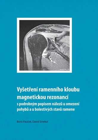 Obálka knihy Vyšetření ramenního kloubu magnetickou rezonancí s podrobným popisem nálezů u omezení pohybů u bolestivých stavů ramene