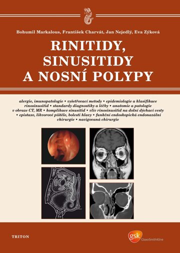 Obálka knihy Rinitidy, sinusitidy a nosní polypy