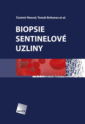 Obálka knihy Biopsie sentinelové uzliny