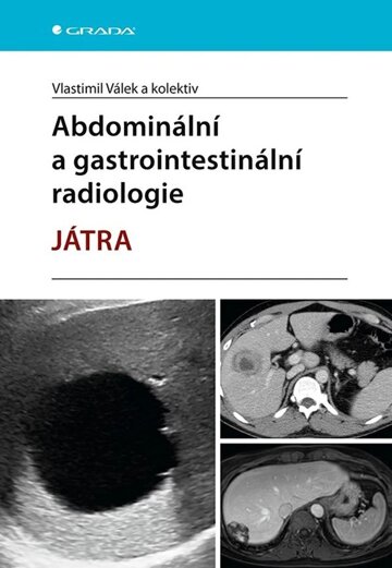 Obálka knihy Abdominální a gastrointestinální radiologie